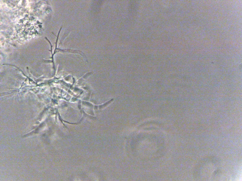 Nocardia Treatment Wastewater